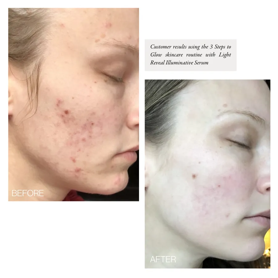 light reveal ILLUMINATIVE EYE serum